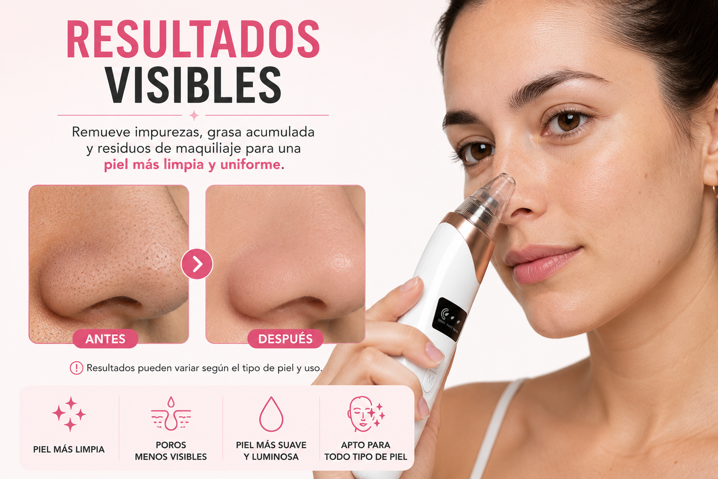 Removedor de Puntos Negros SSGlam™