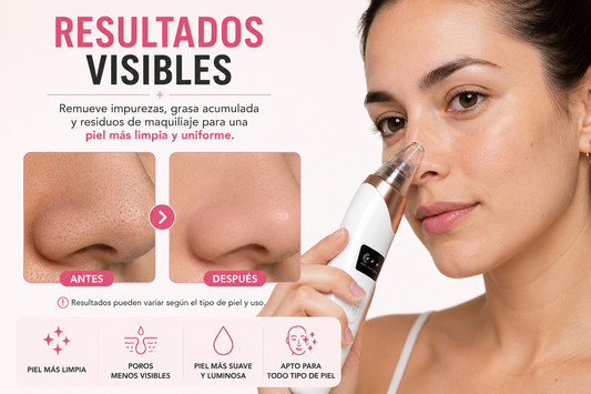 Removedor de Puntos Negros SSGlam™