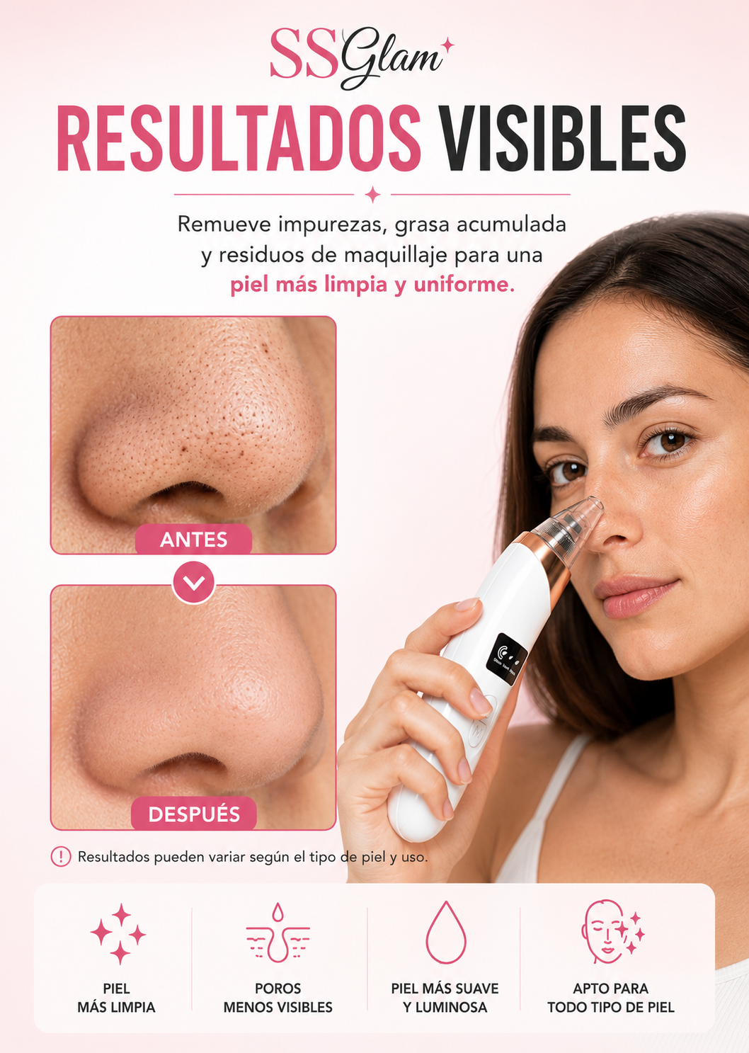 Removedor de Puntos Negros SSGlam™